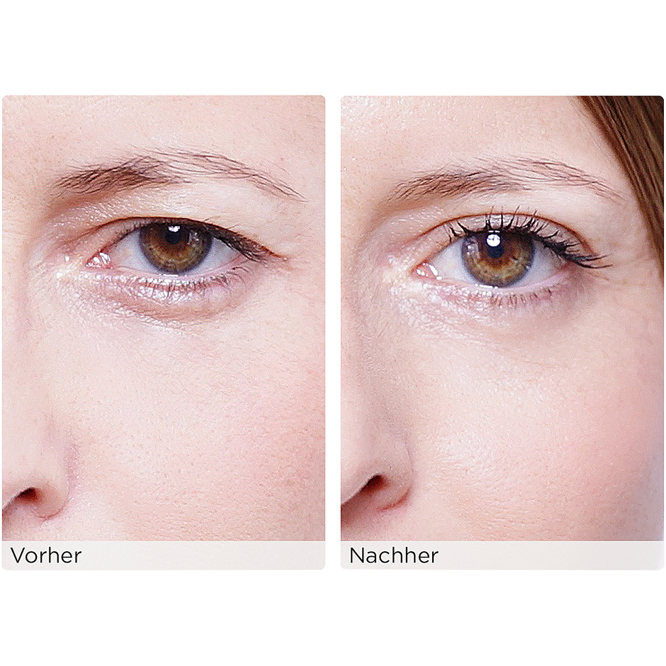 The Instant Eye Lift Without Surgery