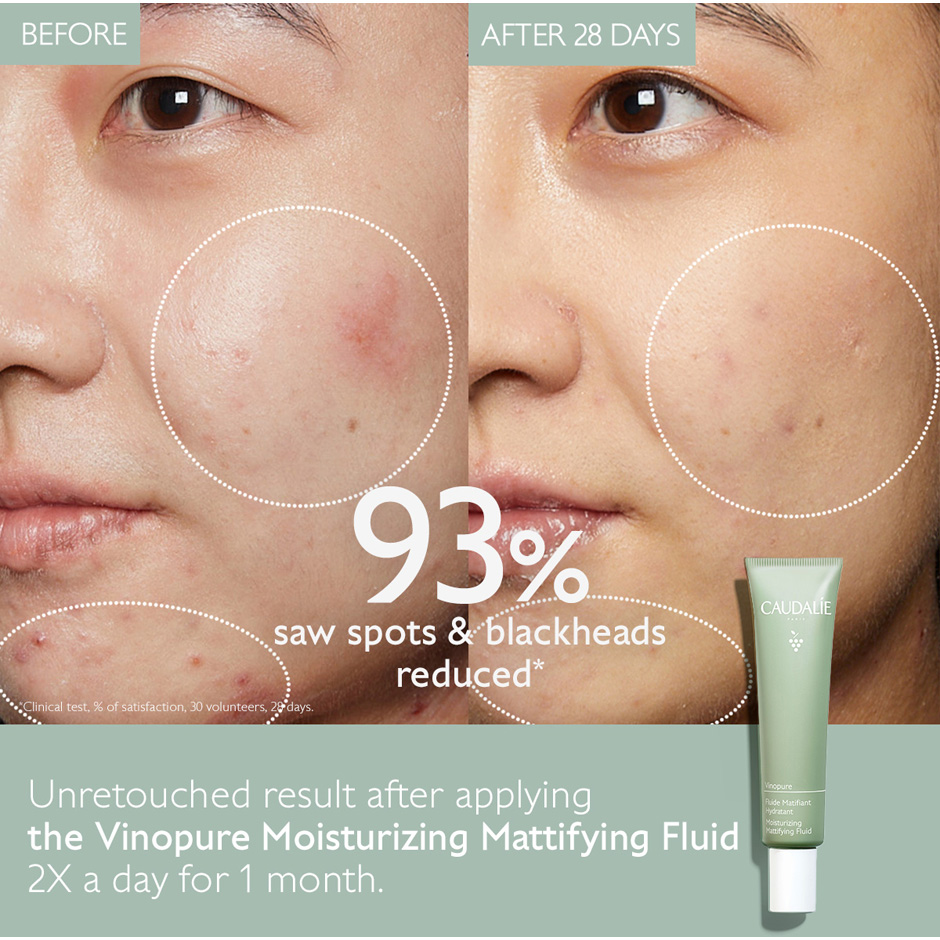 Vinopure Moisturizing Mattifying Fluid