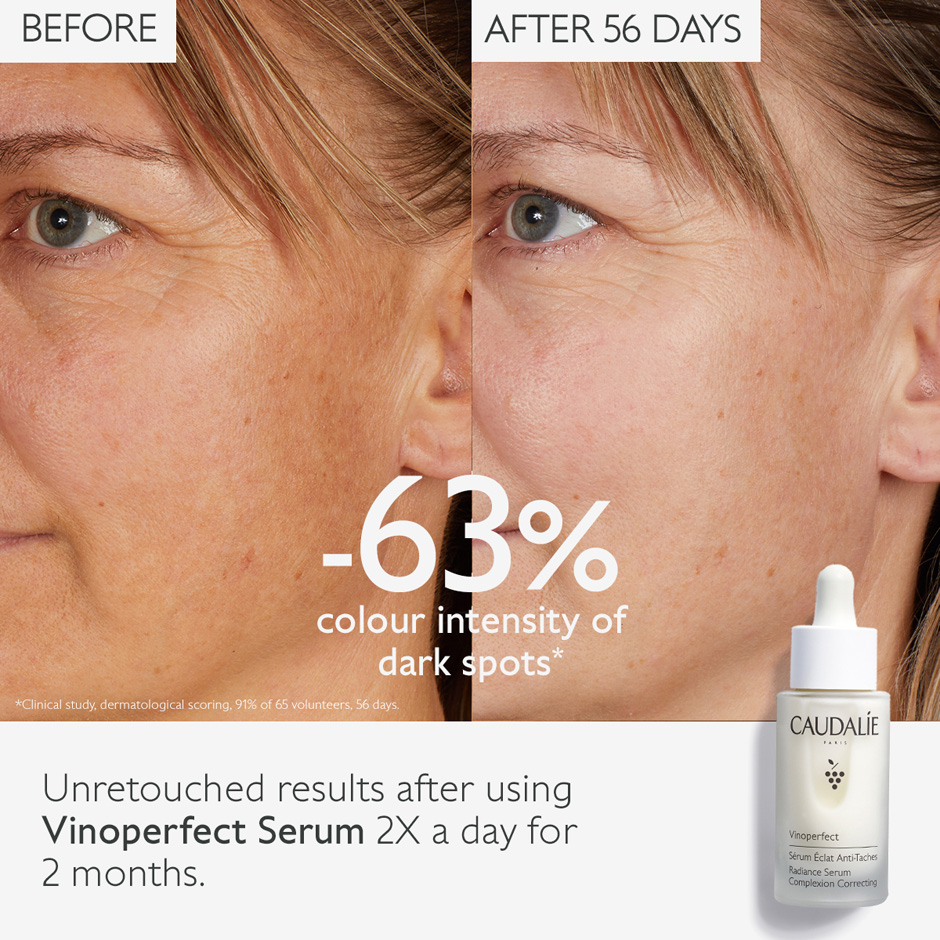 Vinoperfect Radiance Serum Complexion Correcting