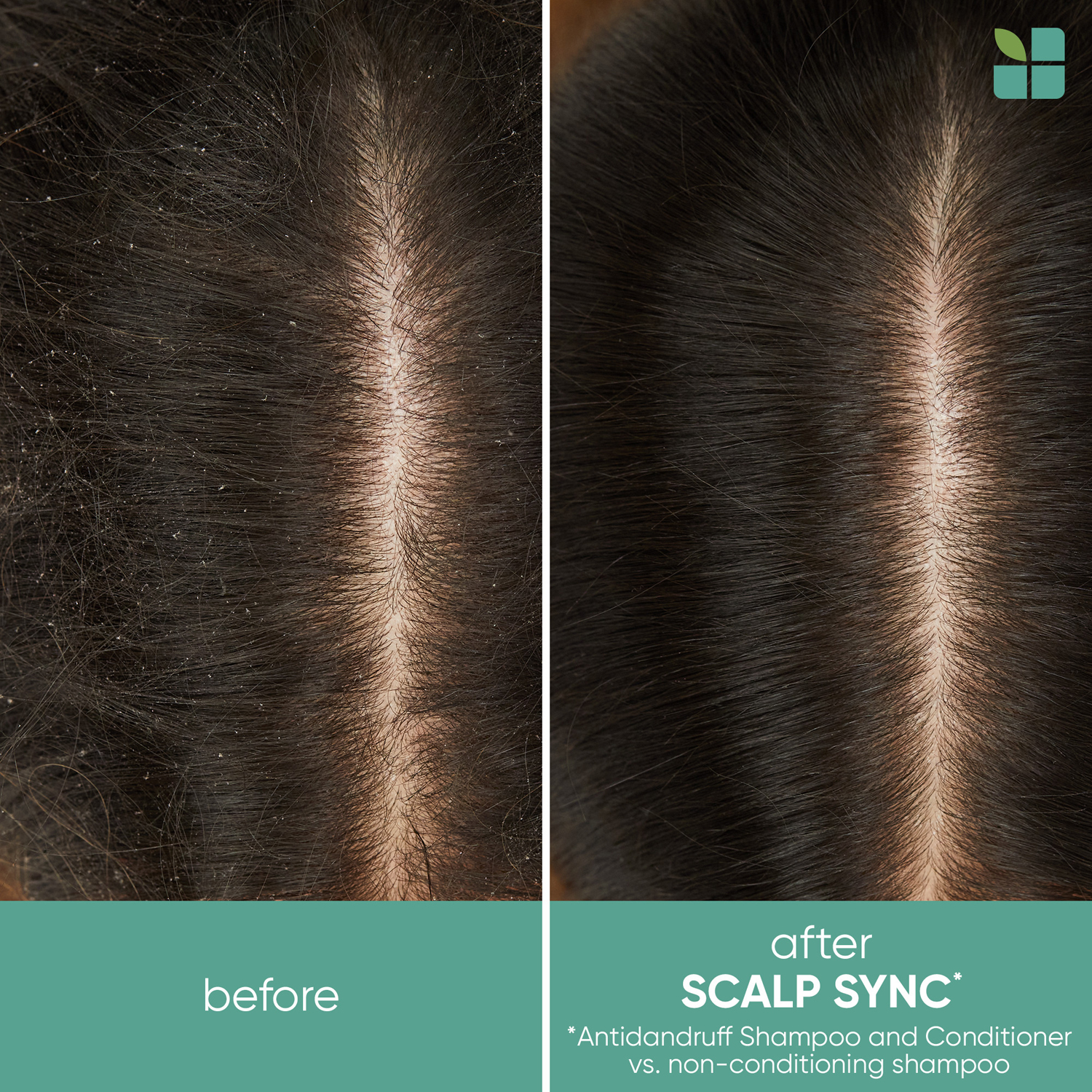 Scalp Sync